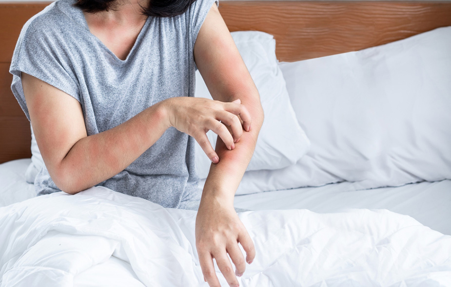 آلرژی و خواب